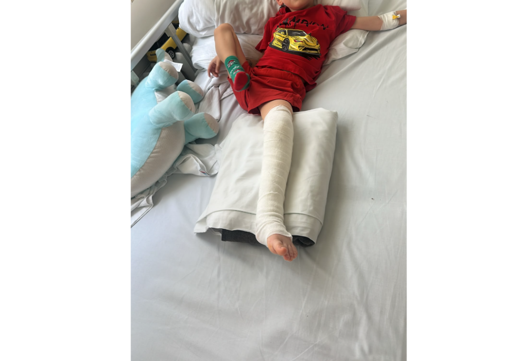 Copil de 4 ani cu fractură gravă la picior după un incident petrecut într-o grădiniță din Brașov. Părinții acuză lipsa supravegherii și întârzierea apelării serviciilor de urgență